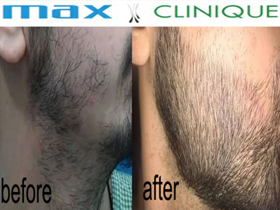 Max-Clinique
