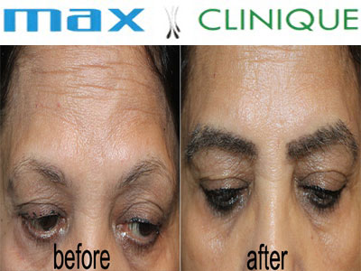 Max-Clinique