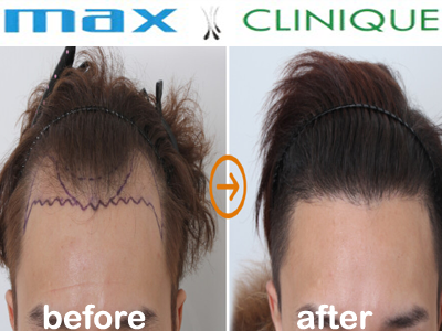 Max-Clinique