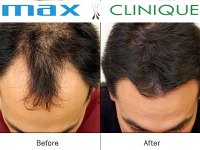 Max-Clinique