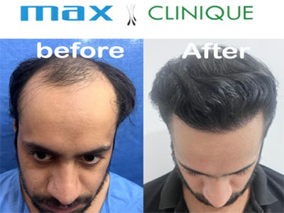 Max-Clinique