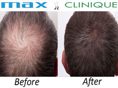 Max-Clinique