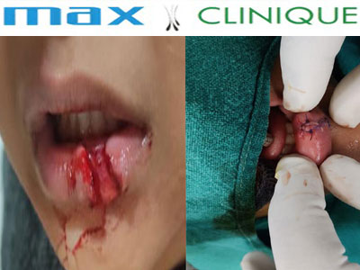 Max-Clinique