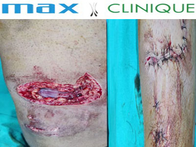 Max-Clinique