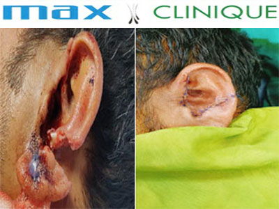 Max-Clinique