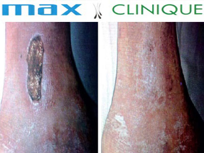 Max-Clinique