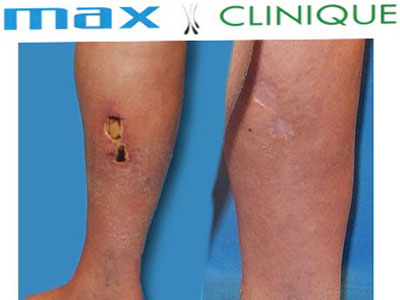 Max-Clinique