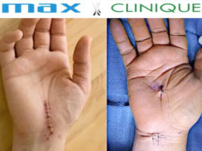 Max-Clinique